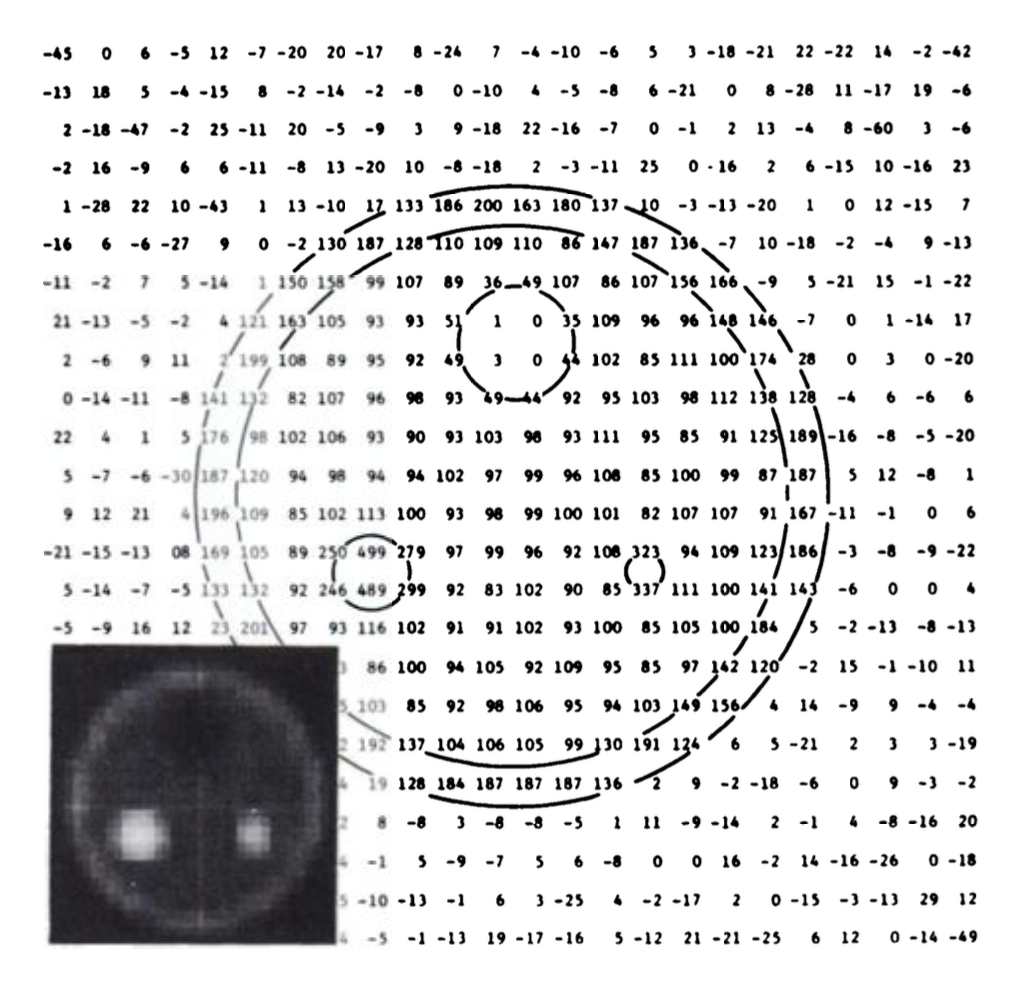 A grid of numbers on a typewritten document represents recorded radiation levels in an early PET test. Inscribed in the lower left-hand corner are those numbers mapped to a black-to-white gradient.